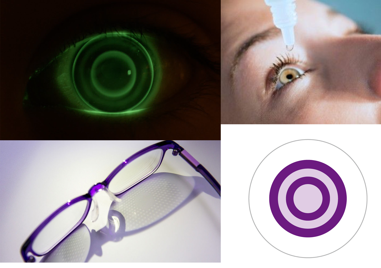 Overview of childhood myopia-control options